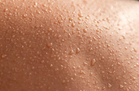 Moistskin